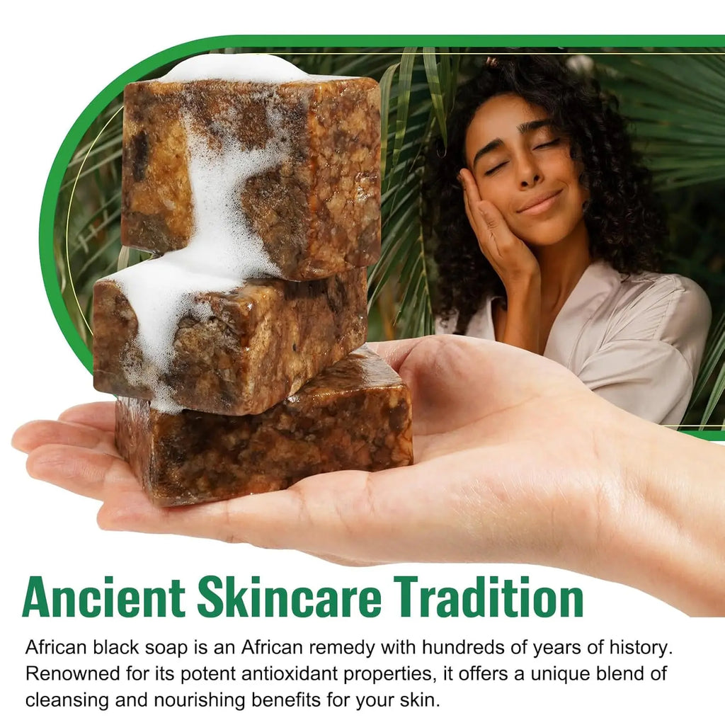 Organic African Black Soap for Acne and Dark Spots