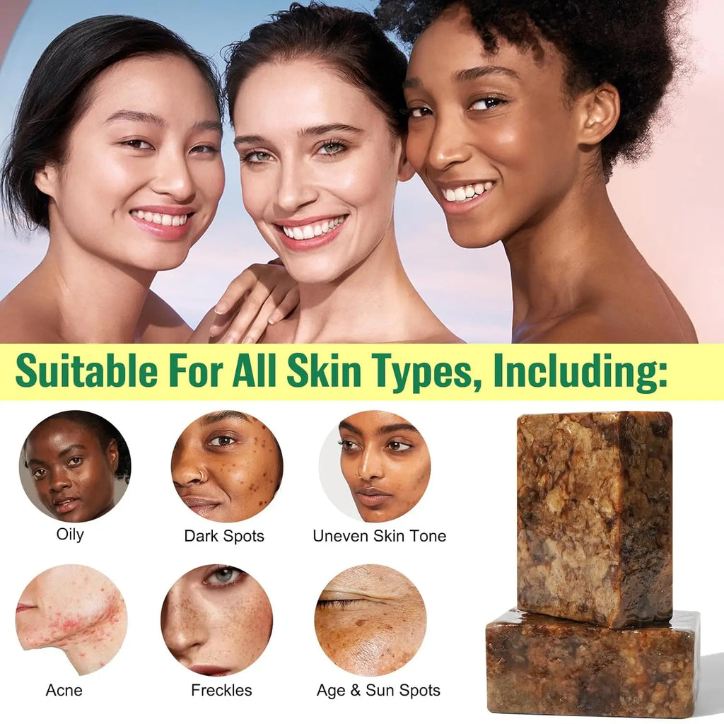 Organic African Black Soap for Acne and Dark Spots