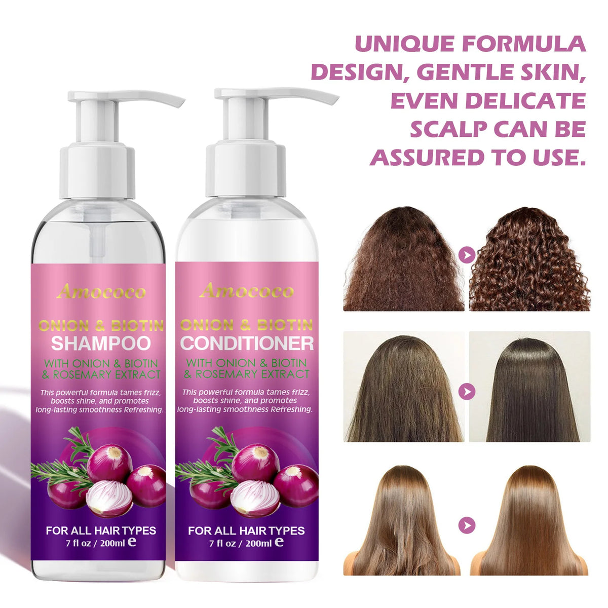 Onion Biotin Rosemary Shampoo and Conditioner Set 6.8 fl oz